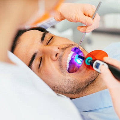 Dental Fillings in Islamabad Rawalpindi & Pakistan