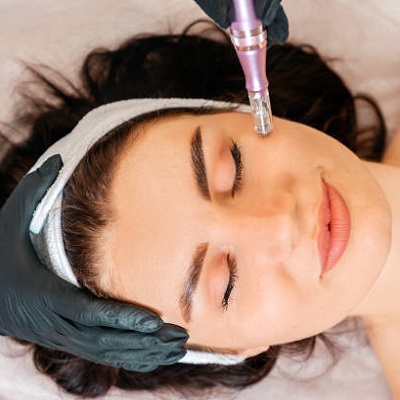 Derma Roller Treatment in Islamabad and Rawalpindi