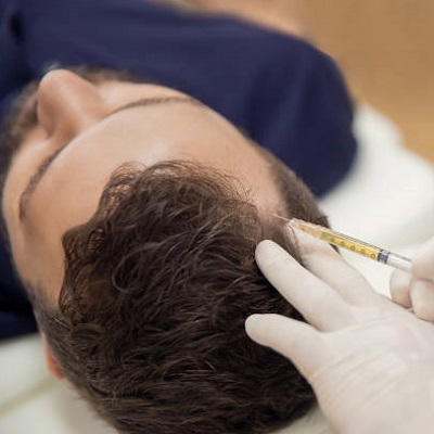 Mesotherapy For Hair Loss in Islamabad