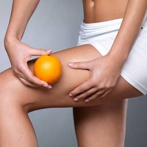 Achieving Cellulite-Free Skin with Expert Treatments