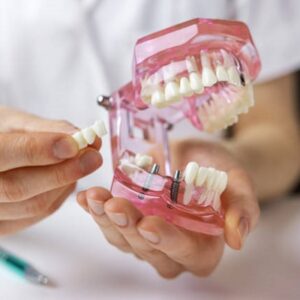 Are dental implants stronger than real teeth?