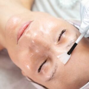 How Chemical Peels Can Transform Your Skin