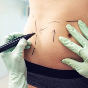 How much does liposuction cost in Islamabad Pakistan?