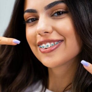 How to choose the best orthodontists in Islamabad?