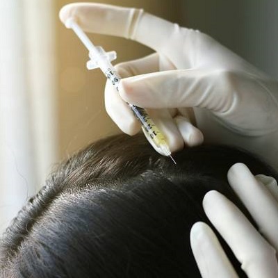 Is Scalp Micro Pigmentation A Better Option Than A Hair Transplant