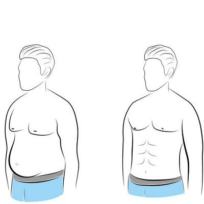 Liposuction for Men Reshaping Masculine Silhouettes