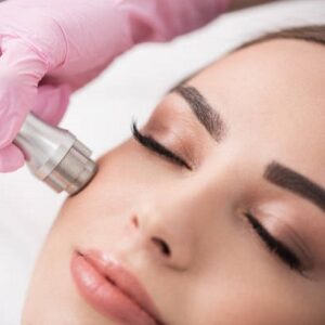 The Benefits of Microdermabrasion for Beautiful Skin