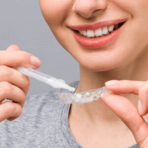 The Role of Dentists in Professional Teeth Whitening