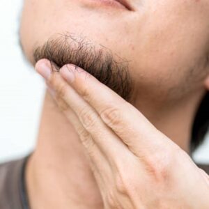 Tips for Maintaining your New Beard After a Transplant