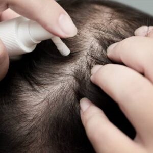 What are the top-rated hair growth treatments?