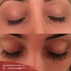 beforeafter of eyelash extension in Islamabad