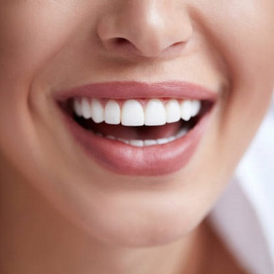 How many teeth whitening sessions do you need?